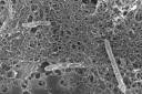 Bacteria under a microscope